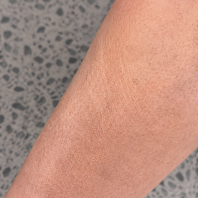 Dull Skin