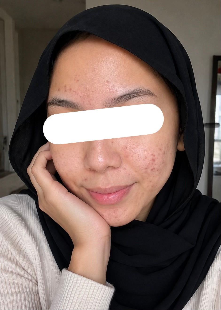 After 14 Days
