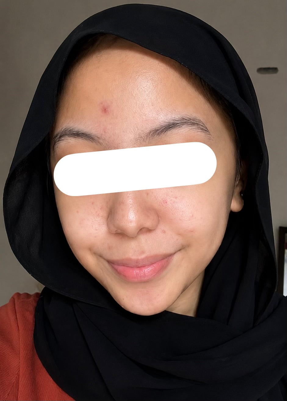 After 1 Month