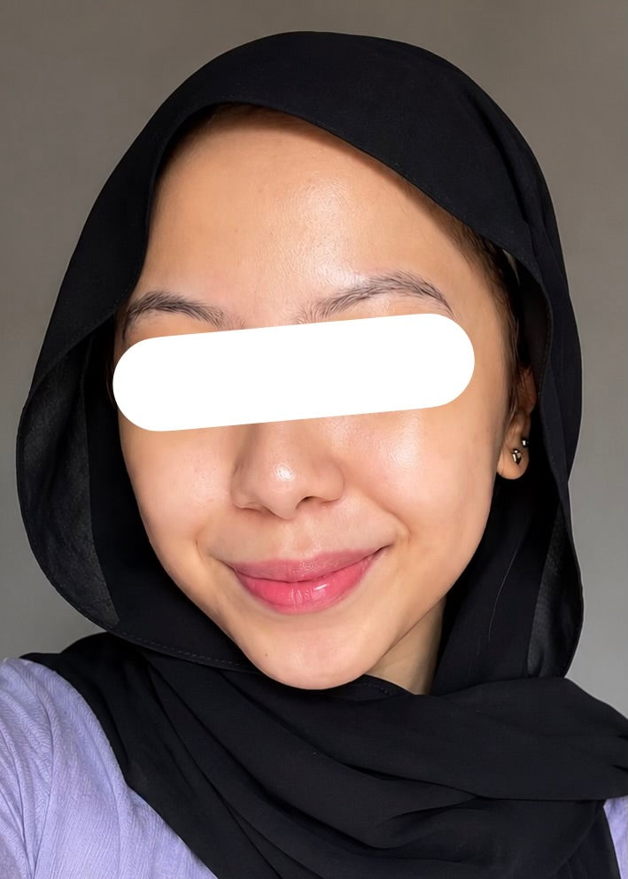 After 3 Months