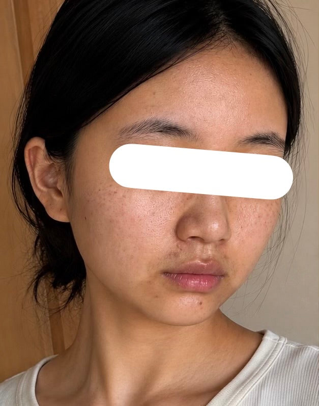 After 14 Days
