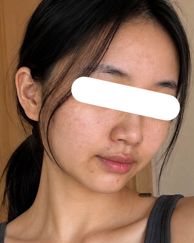 After 1 Month