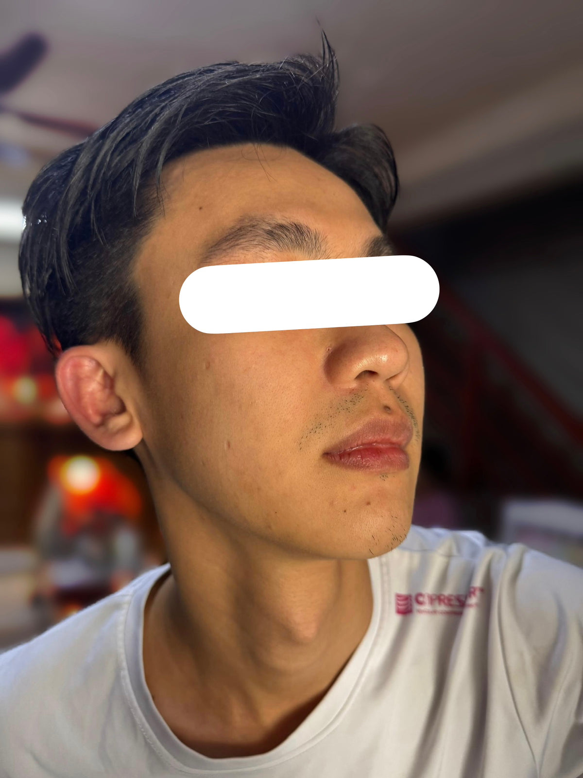 After 14 Days