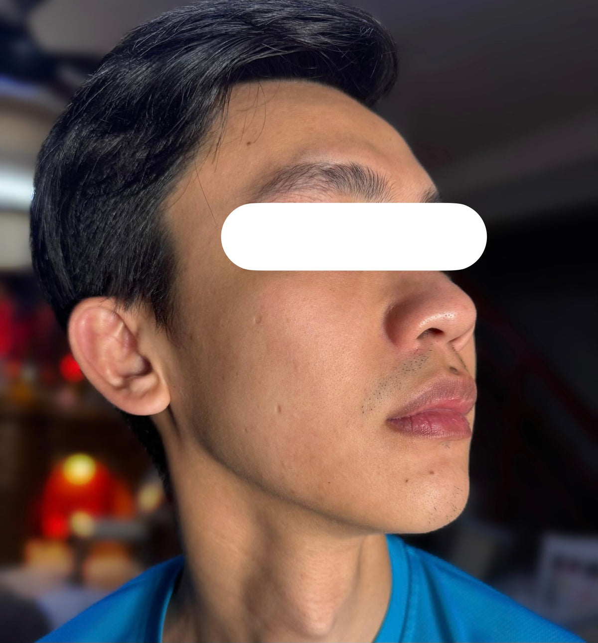 After 1 Month